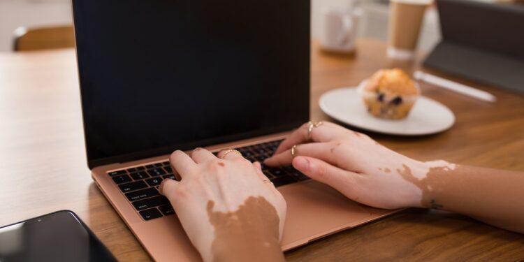 Active Force Electric Field Anti-Pathogenic Fabric